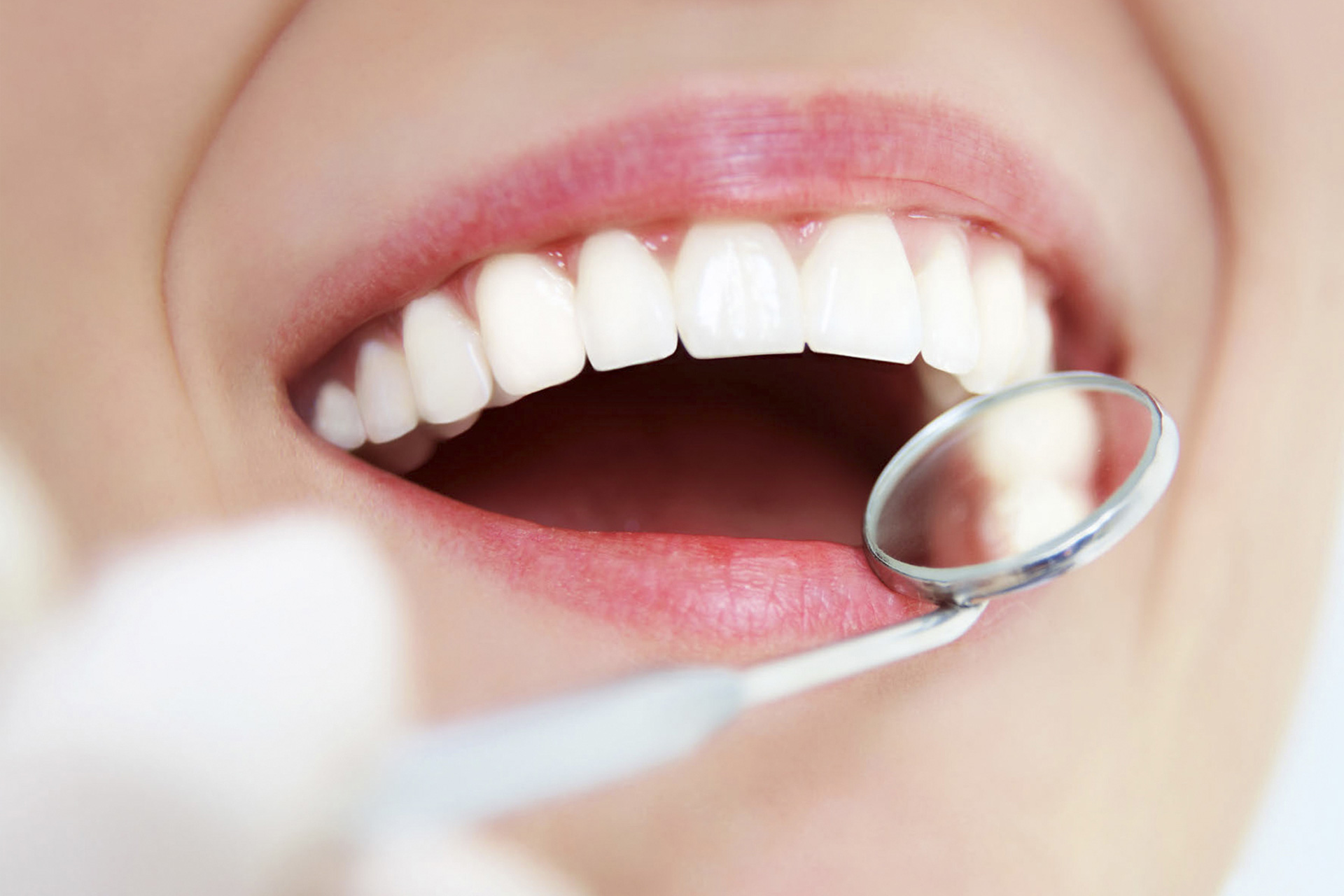 Cosmesi Dentale