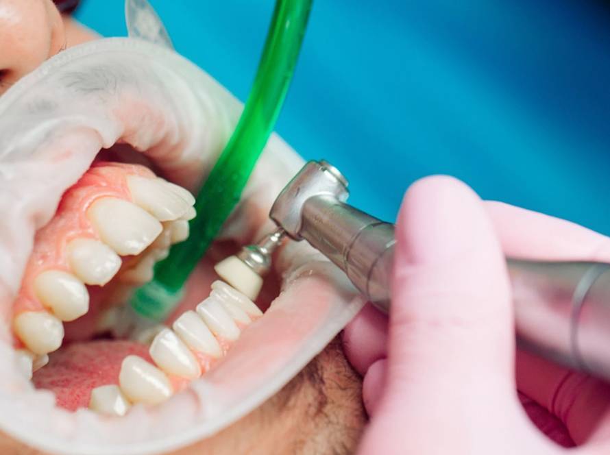 Magna Graecia Institute - Igiene Dentale e Profilassi a Taranto