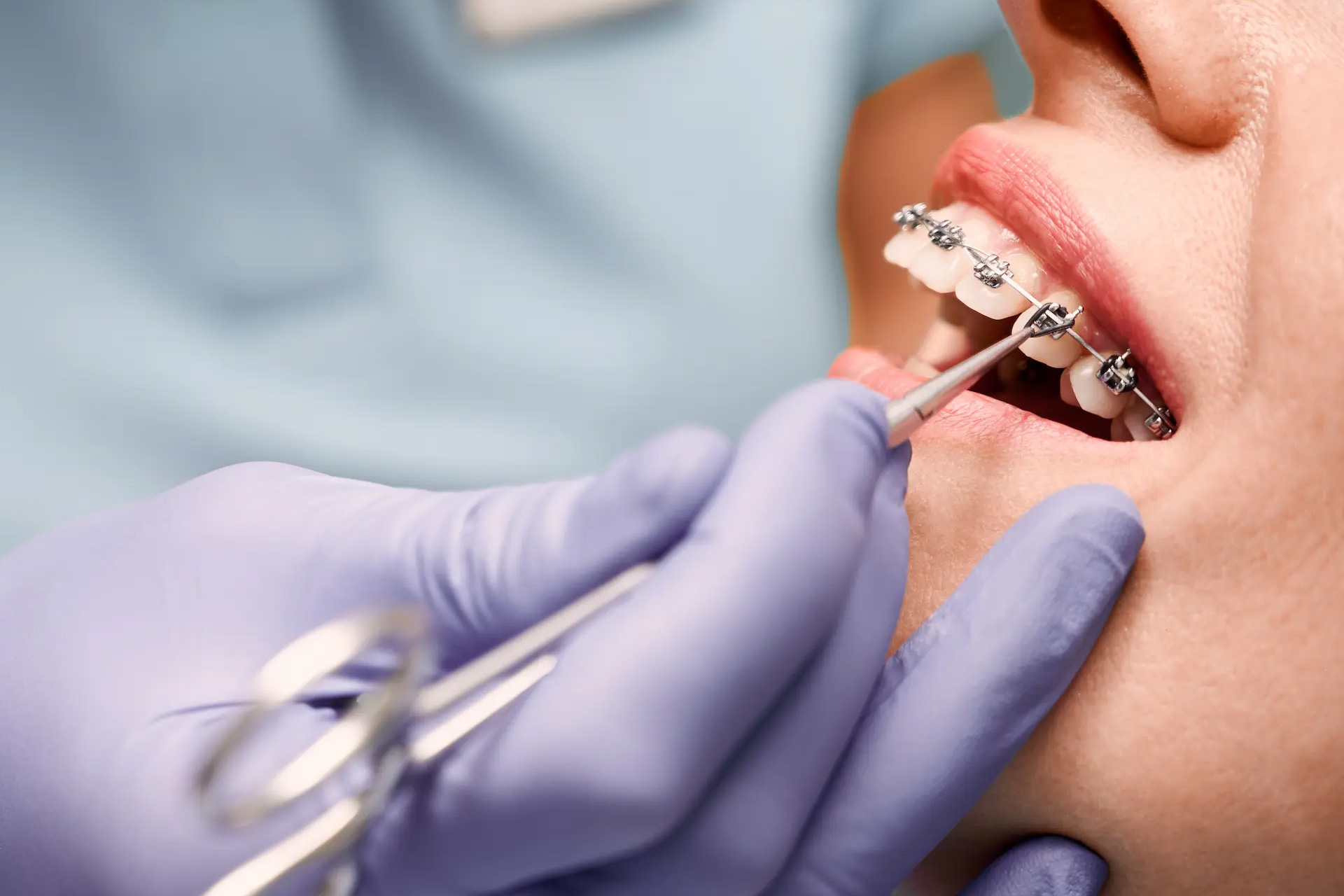 Ortodonzia Adulto e Bambino